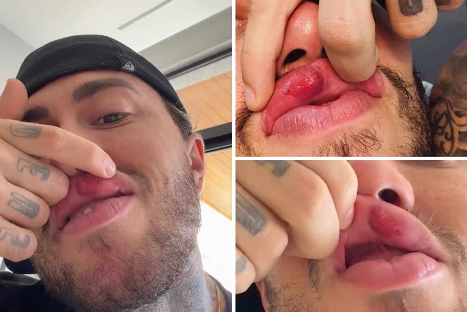 MC Daniel se revolta e exibe machucado após lance em jogo beneficente