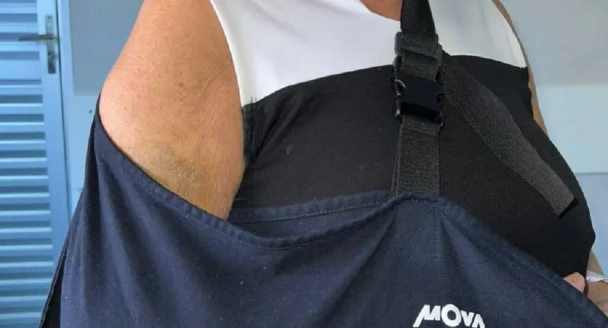 Merendeira aguarda cirurgia há quase um mês após acidente em Rondônia