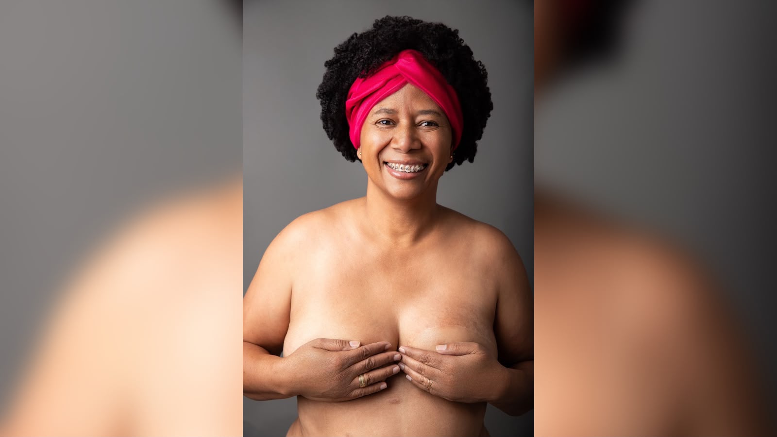 HISTÓRIA DE SUPERAÇÃO – Sílvia Cristina transforma experiência com câncer em missão pela saúde