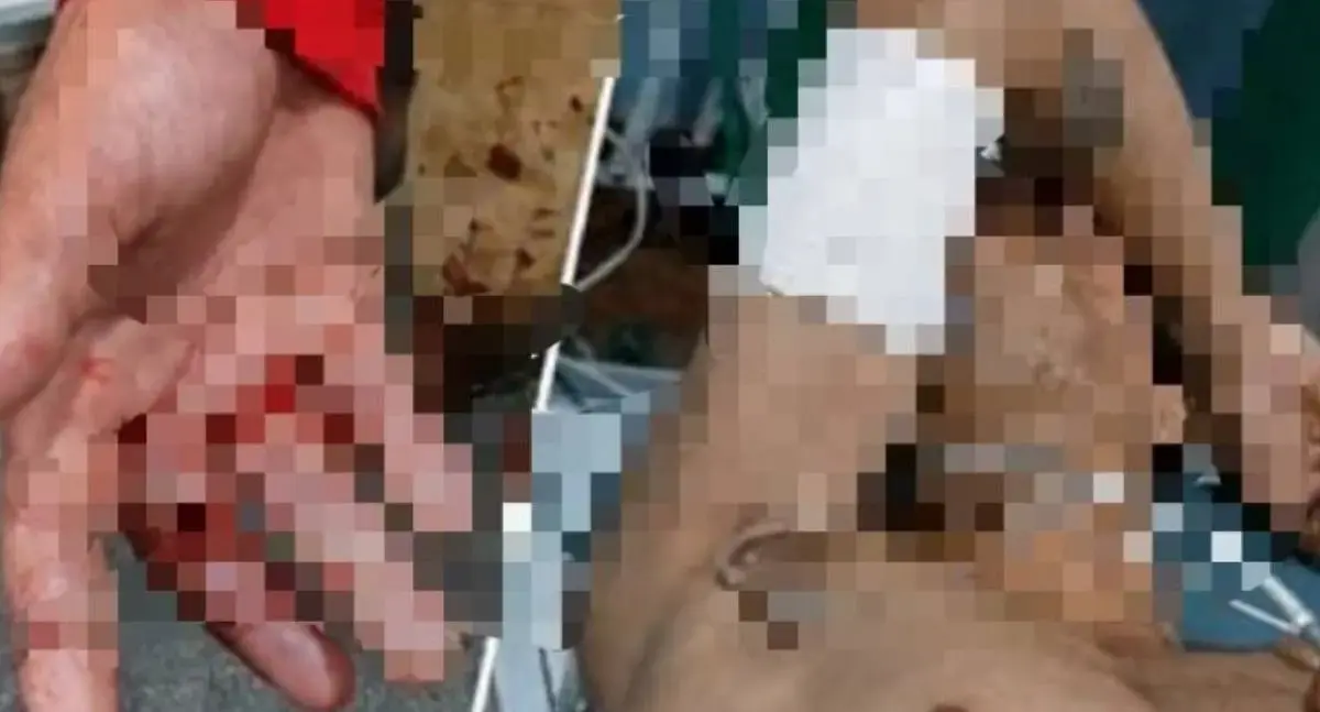 Tentativa de homicídio deixa um morto e um ferido em RO
