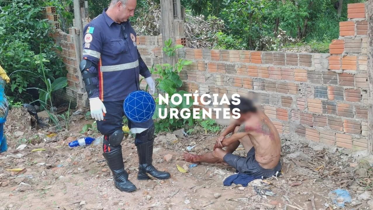 Homem fica gravemente ferido após ser espancado por causa de R$ 20