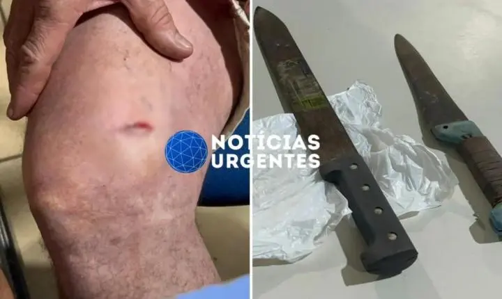 Comerciante é esfaqueado ao tentar separar briga entre bolsonarista e petista