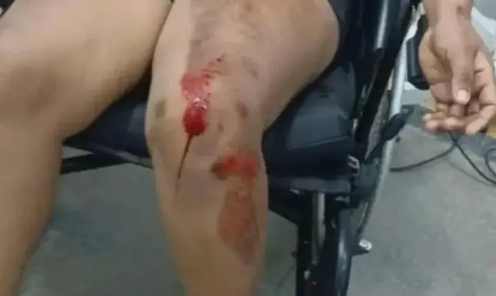 Criança de 8 anos aciona PM depois de pai agredir mãe e deixá-la desacordada em RO