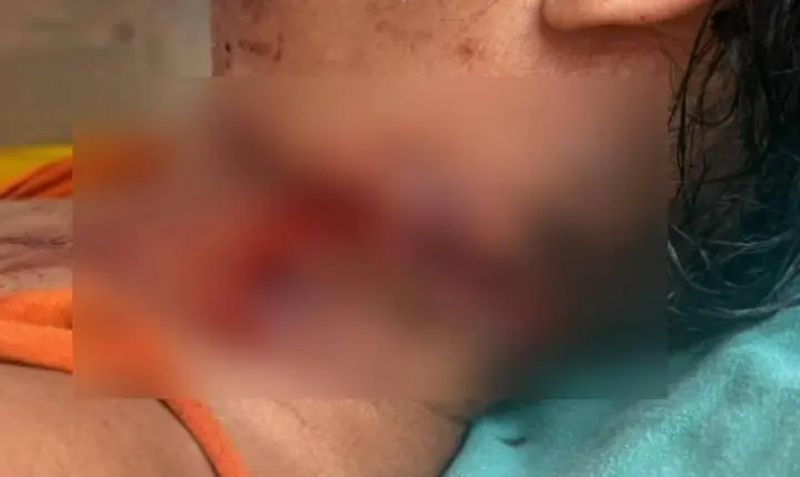 Mulher é socorrida com ferimento no pescoço e Polícia Civil investiga o caso em São Francisco do Guaporé